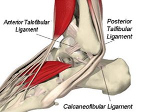 ankle-ligamenttear