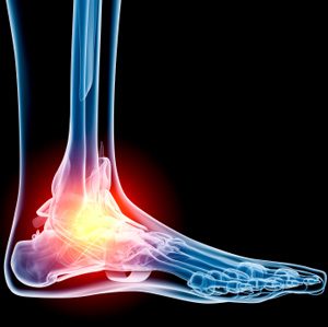 ankle-pain-conditions-and-treatments-300x299